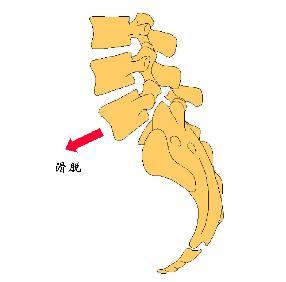 日常如何预防腰椎出现滑脱